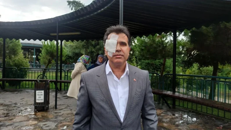 Romanlar Konfederasyonu Başkanı Ahmet Çokyaşar’a saldırı