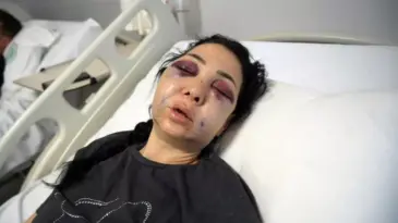 Oğlunun gözü önünde anneyi öldüresiye dövdüler: “‘Küfür etmeyin’ dedik diye bu hale geldim”