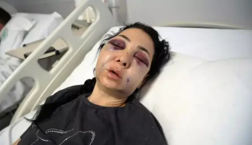 Oğlunun gözü önünde anneyi öldüresiye dövdüler: “‘Küfür etmeyin’ dedik diye bu hale geldim”